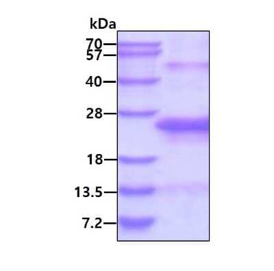 SDS-Page: Recombinant Human IgJ His Protein [NBP2-23132] - 3ug by SDS-PAGE under reducing condition and visualized by coomassie blue stain.